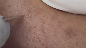 Черные точки на щеках. Удаление мастера.