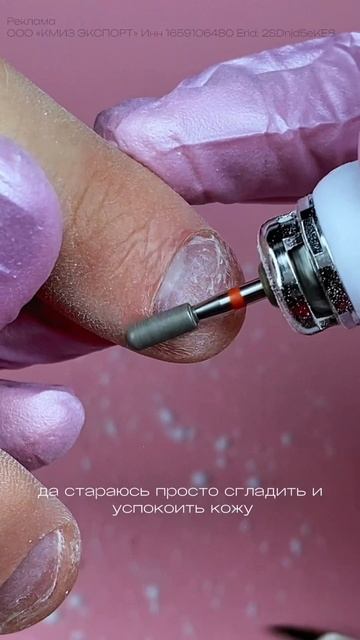 онихофагия — грызет ногти вторая часть обработки 💔 первую часть смотри в ленте как вам результат? смотреть онлайн