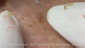 СТРАННЫЕ ШТУКИ черные точки. Зрелище для ценителей