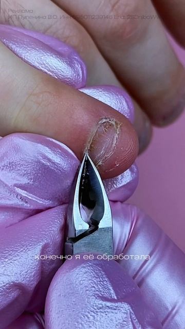 грызун — сложный случай онихофагии 💔 бережная обработка ногтей продолжение уже ленте смотреть онлайн