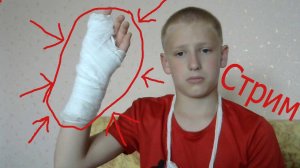 Хейтеры подлецы сломали руку.п