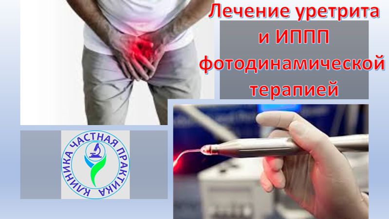 Лечение уретрита и ИППП фотодинамической терапией смотреть онлайн