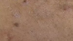 Извлечение чёрных точек и белых угрей | Увлекательное видео