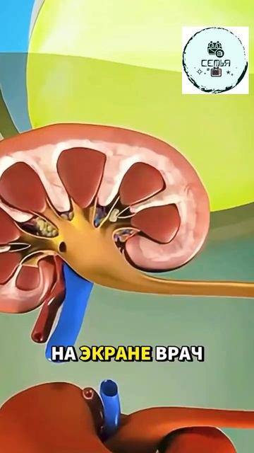 НАГЛЯДНАЯ РАБОТА УДАЛЕНИЯ КАМНЕОБРАЗОВАНИЙ В ОРГАНИЗМЕ ЧЕЛОВЕКА смотреть онлайн