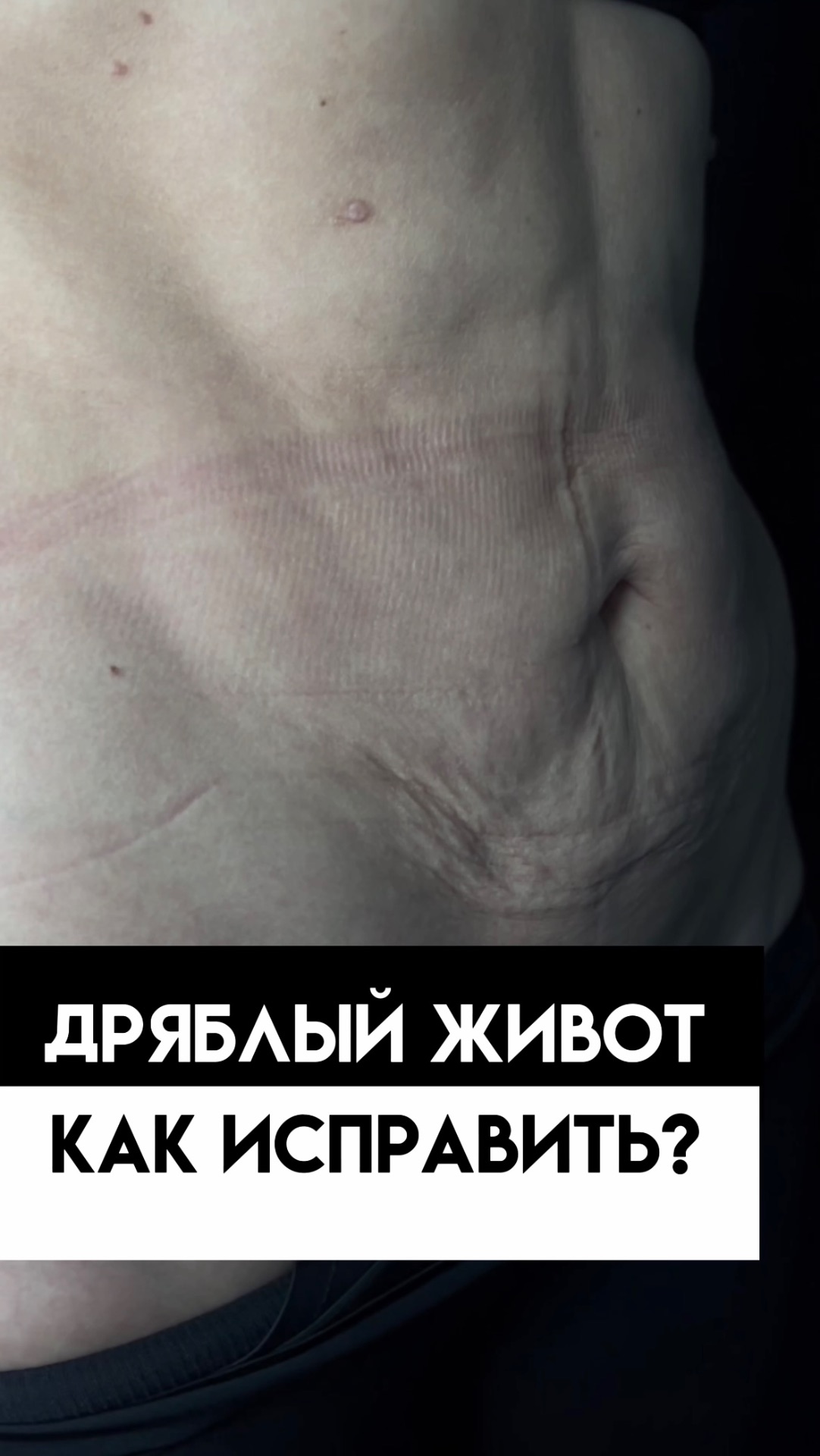 Дряблый живот – как исправить? смотреть онлайн