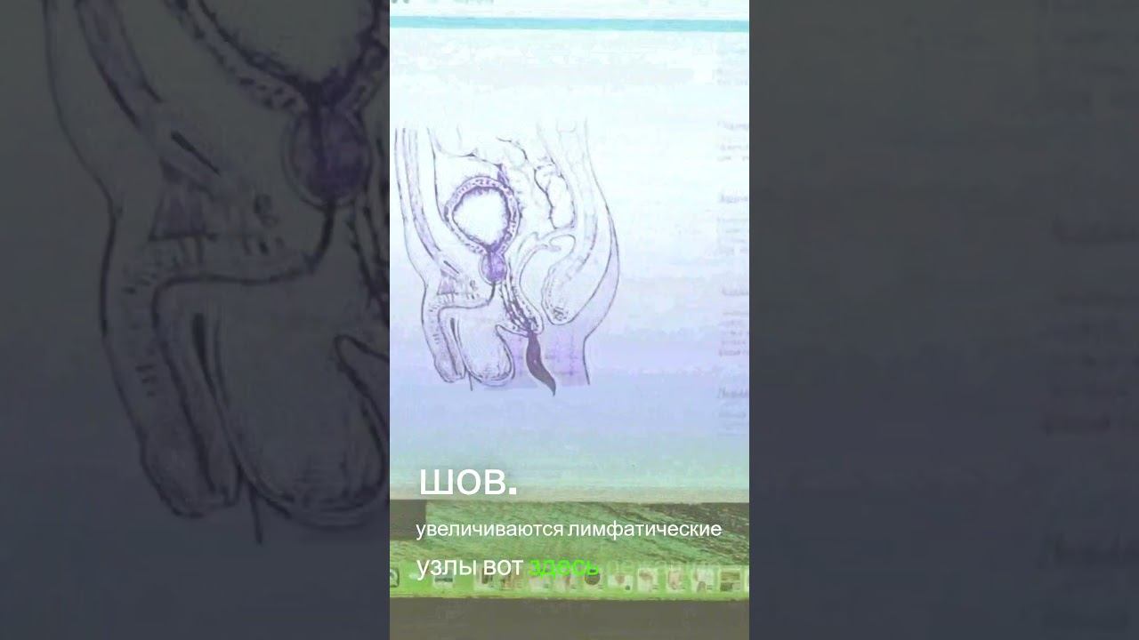 Влияние родов на неврологические процессы! Личный опыт смотреть онлайн