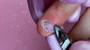 грызун — сложный случай онихофагии 💔 бережная обработка ногтей (полная версия)