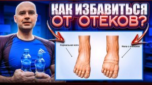 Как избавиться от отёков?