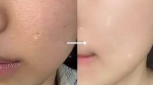 👩🫧ЧИСТАЯ КОЖА｡･:*:･ﾟ’☆