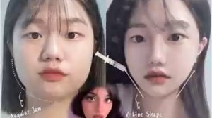 💁♀️\/ВИ-ОБРАЗНОЕ ЛИЦО｡･:*:･ﾟ’☆