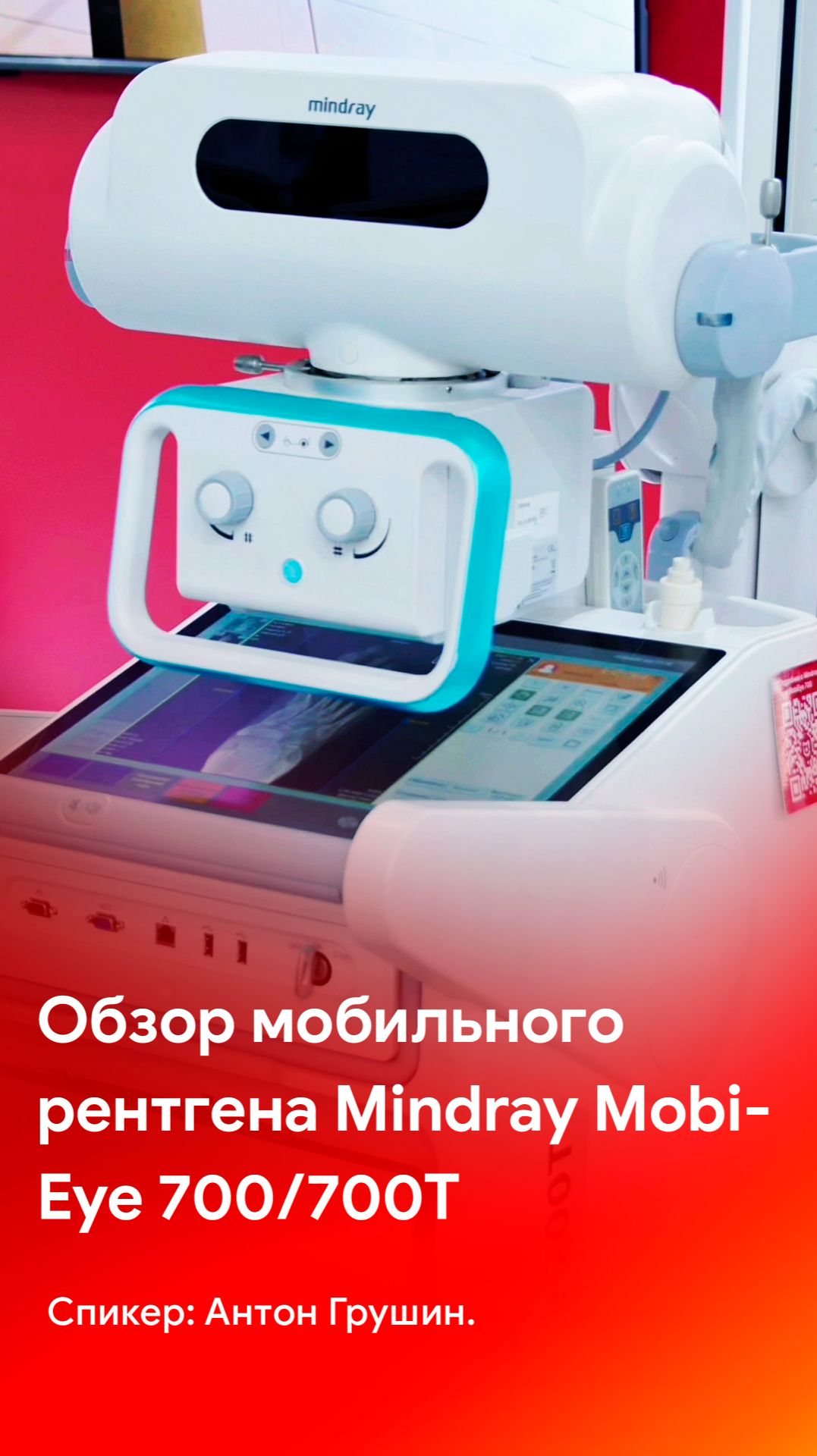 Обзор палатного рентгена Mindray MobiEye 700/700T - уже на канале MEDLIGA смотреть онлайн