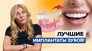 ЗУБНЫЕ ИМПЛАНТАТЫ. ТОП ЛУЧШИХ! Дешевый, средний и дорогой зубной имплант.