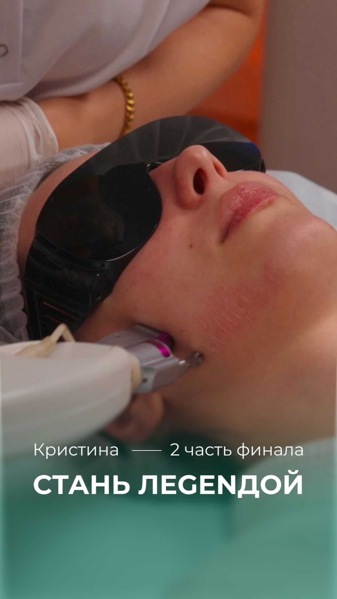 Как убрать рубцы? Лазерная шлифовка кожи Ipixel делает рельеф гладким | клиника GEN87 смотреть онлайн