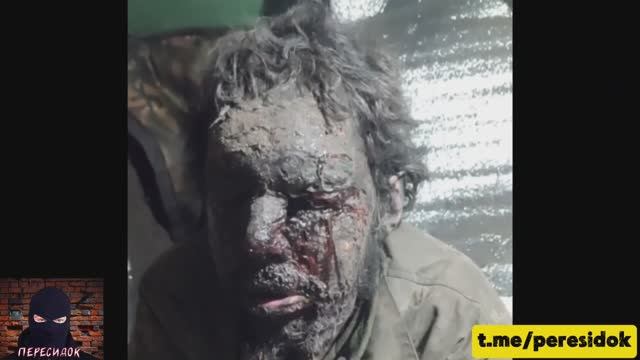 Послание ВСУшника после пережитого взрыва от противотанковой мины смотреть онлайн