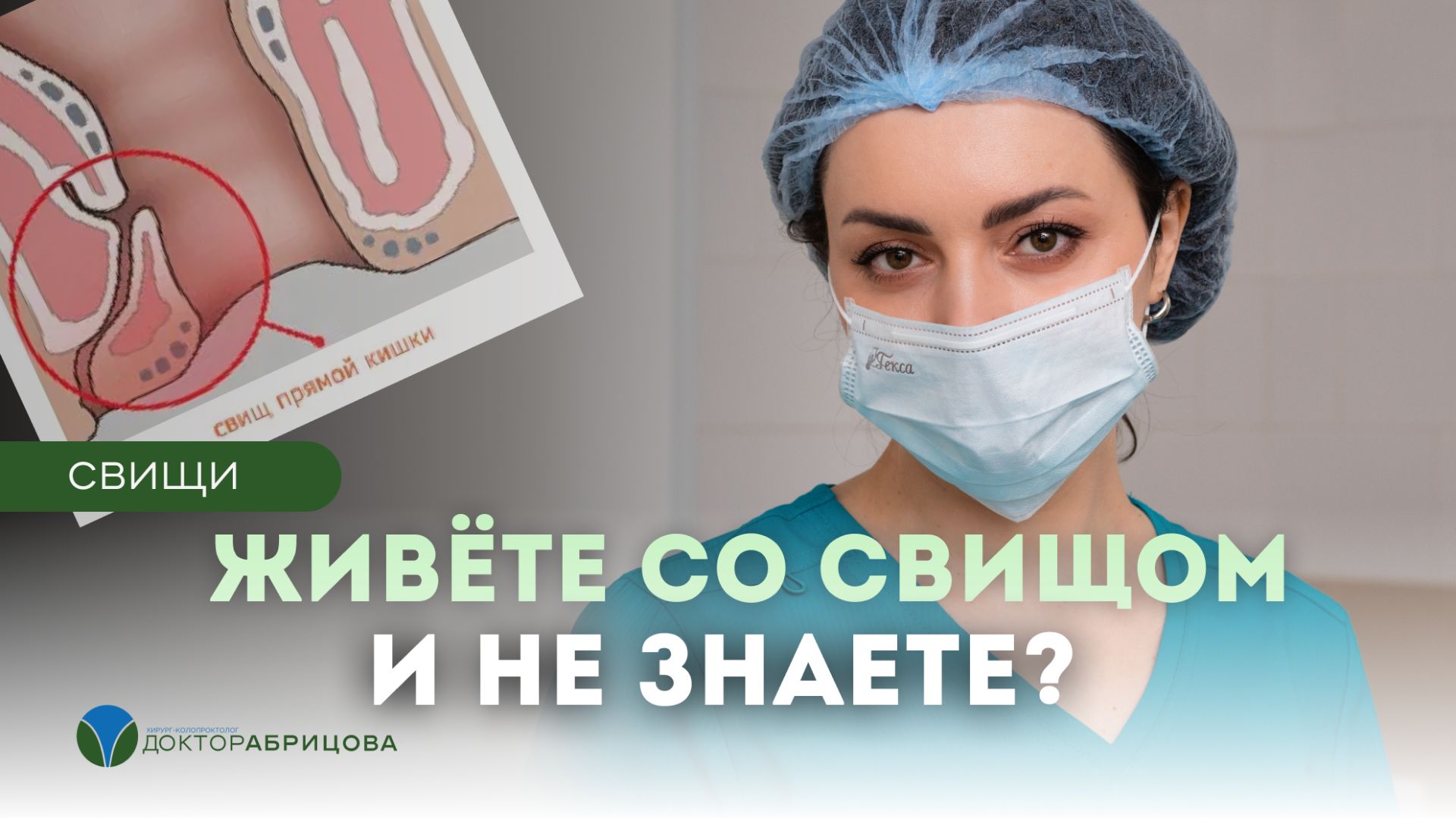 Парапроктит и свищ: гной вышел — стало легче? Почему это не означает выздоровление смотреть онлайн