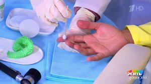 Крио против бородавок. Жить здорово! Фрагмент выпуска от 21.01.2026