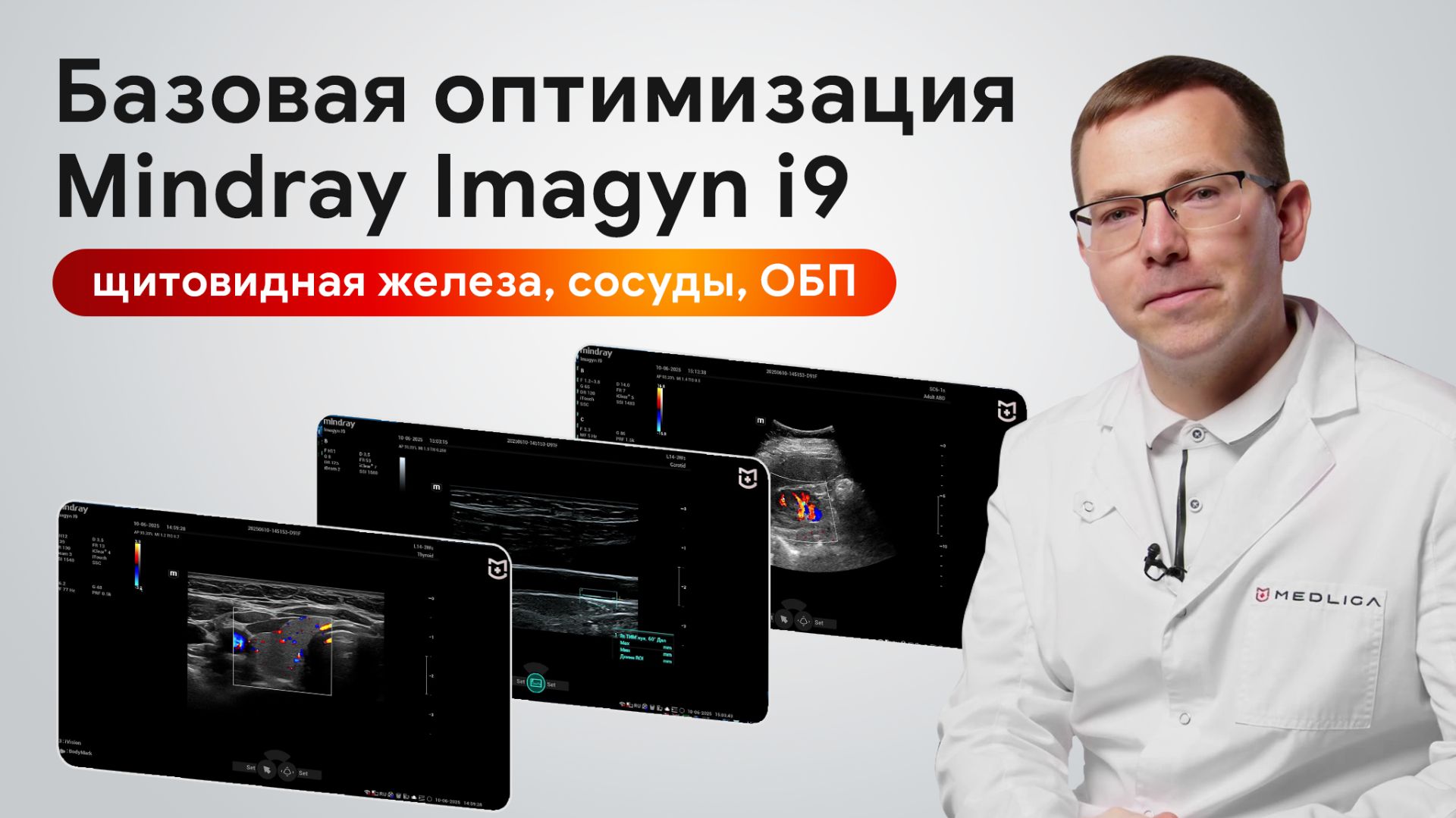 Базовая оптимизация Mindray Imagyn i9: щитовидная железа, УЗИ сосудов, брюшной полости смотреть онлайн