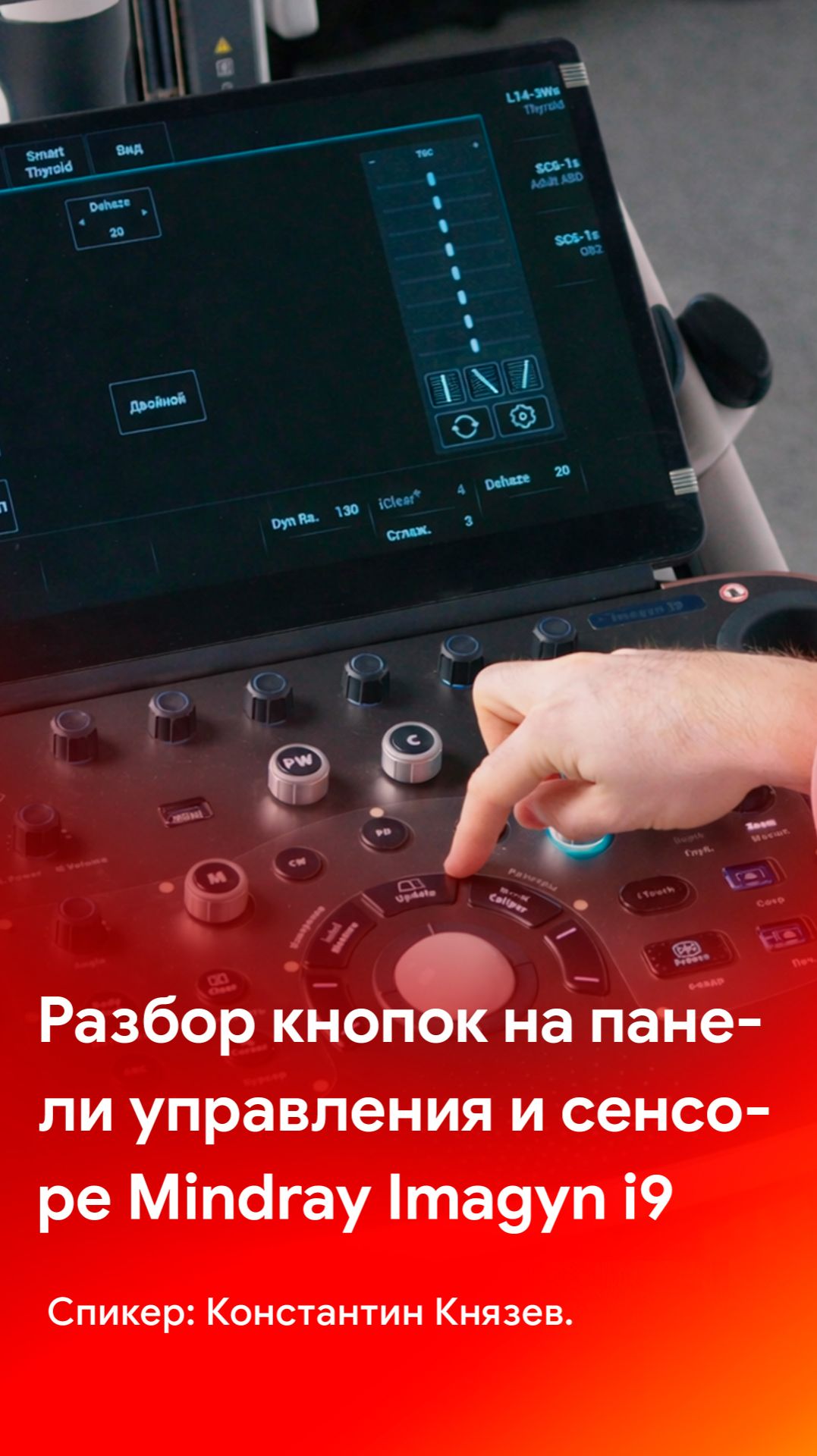 Разбор кнопок на панели управления и сенсорном экране Mindray Imagyn i9 смотреть онлайн