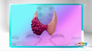 Узел в щитовидке: паниковать или действовать? Жить здорово! Фрагмент выпуска от 22.01.2026