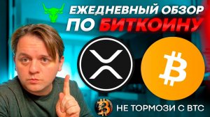 STABLE.C.D БОЛТАЕТСЯ НА ПОДДЕРЖКЕ. ОБНОВЛЕНИЕ НА COINGLASS!! #XRP