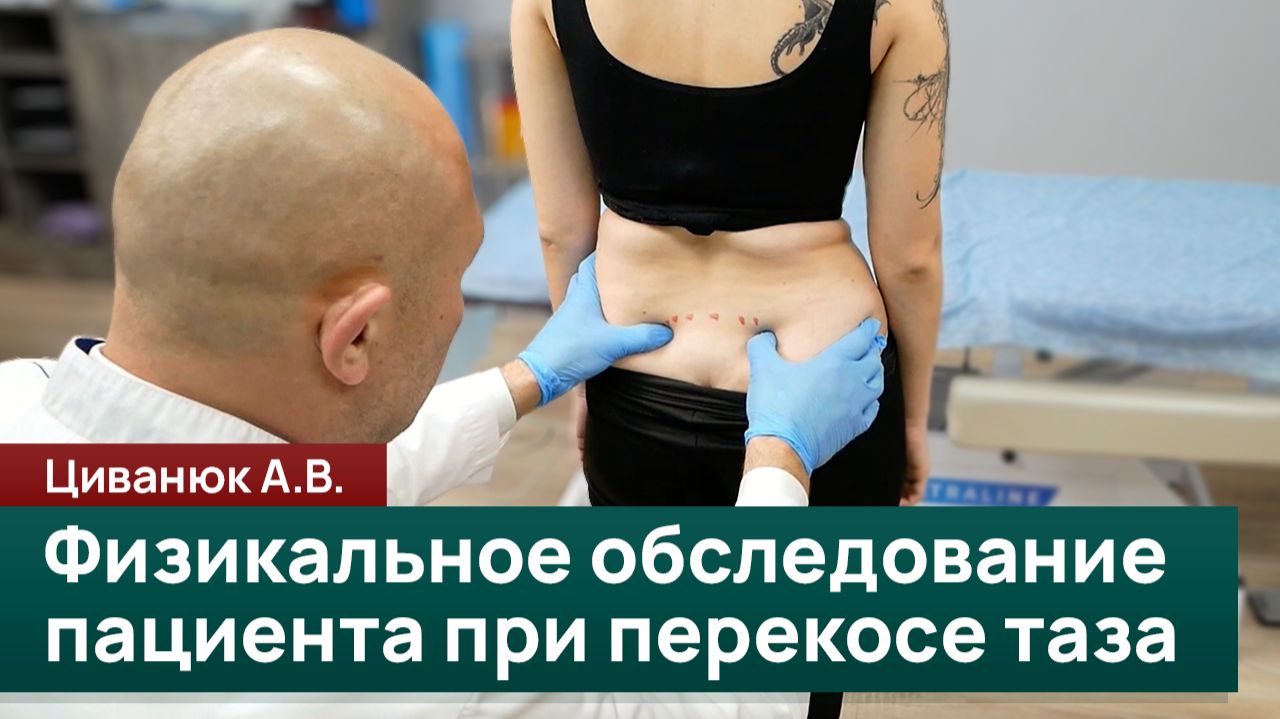 Физикальное обследование пациента при перекосе таза. Циванюк А.В. смотреть онлайн