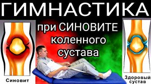 Упражнения при синовите коленного сустава / Гимнастика при воспаление синовиальной оболочки