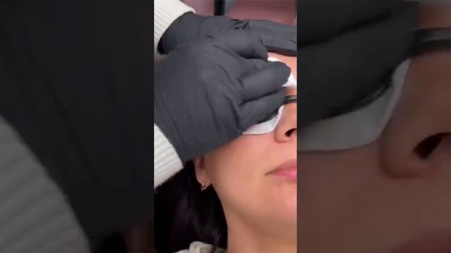 Аппарат Лазер с карбоновый пилингом смотреть онлайн