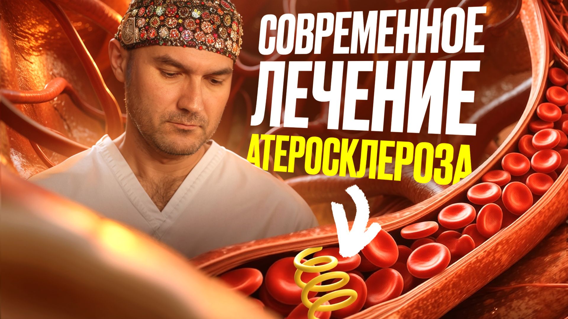 Атеросклероз сонных артерий — как лечат в 2026? смотреть онлайн