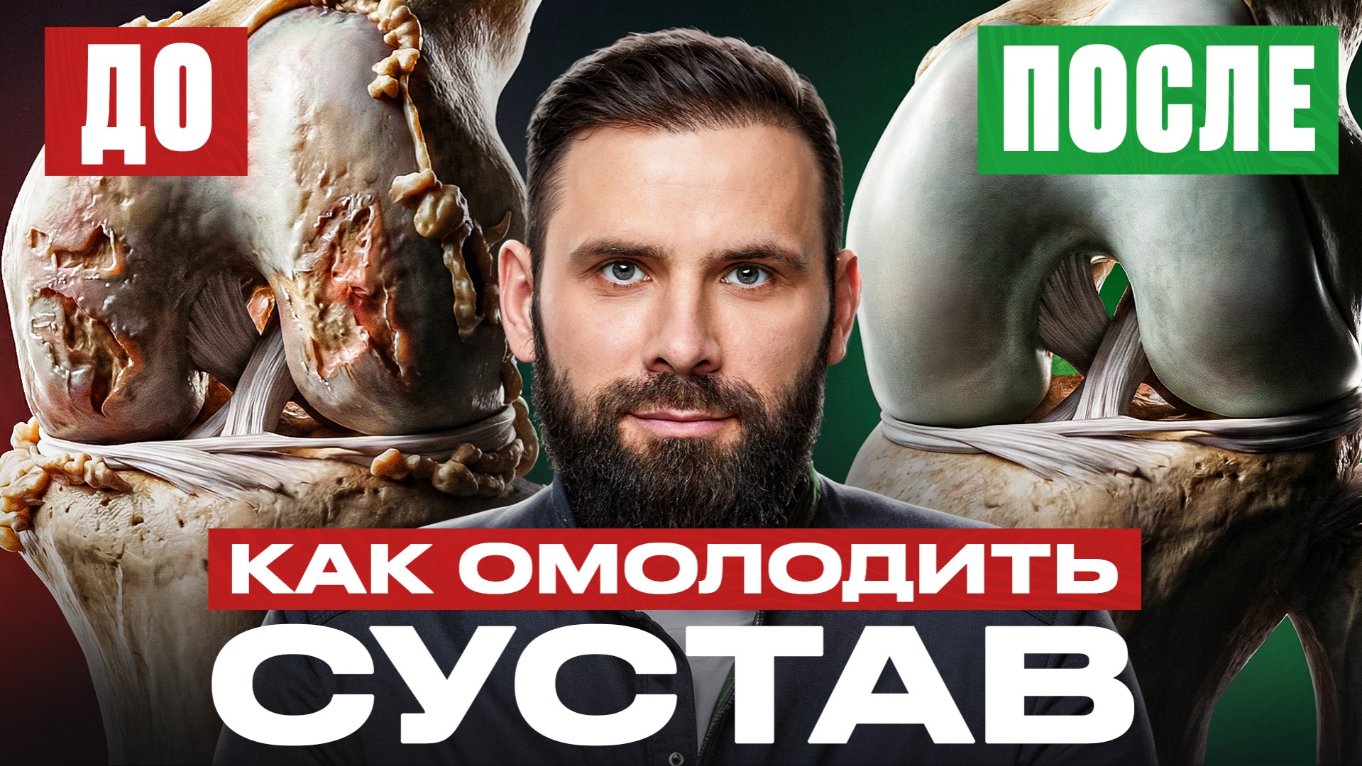 Секрет здоровых суставов. Как ходить легко и БЕЗ боли смотреть онлайн