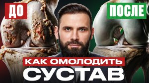 Секрет здоровых суставов. Как ходить легко и БЕЗ боли