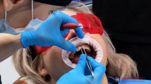 Гигиена полости рта по протоколу GBT