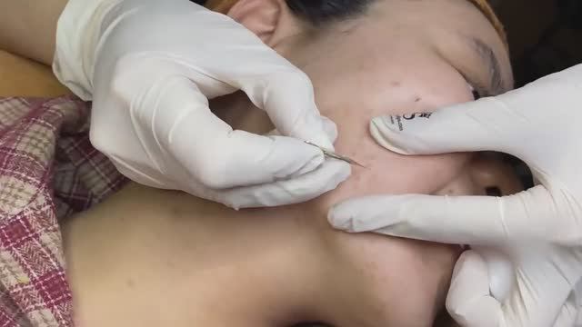 Первая чистка чёрных точек у милой девушки - SDS134 смотреть онлайн