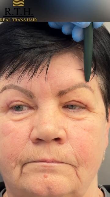 10 дней после сложной операции. смотреть онлайн