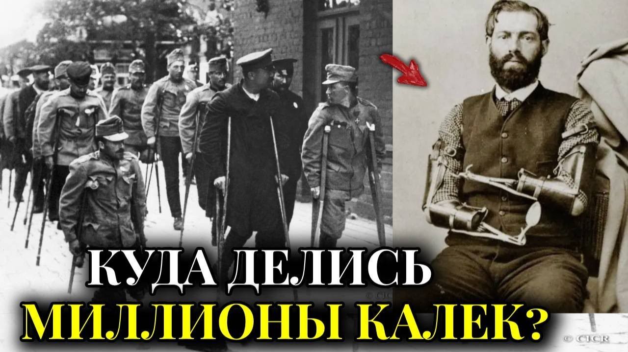 МИЛЛИОНЫ КАЛЕК ПРОСТО ИСЧЕЗЛИ： Куда делись инвалиды после войн 19 века？ смотреть онлайн