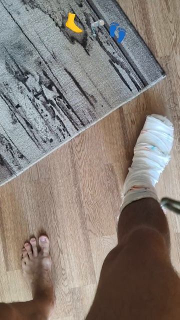 Заживающее копытце 🦿🦶 смотреть онлайн