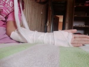 Слосаная рука лайк и она луче станет