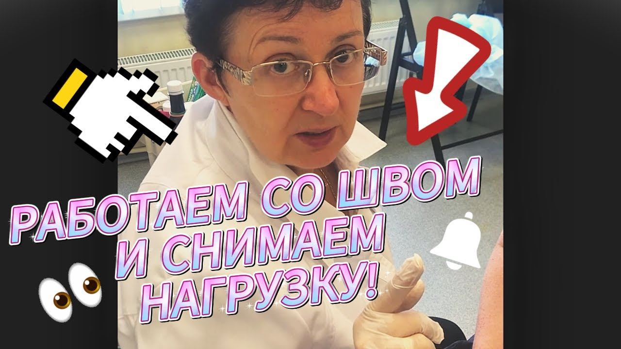 Отекает рука после операции? Как помочь лимфе найти новый путь смотреть онлайн