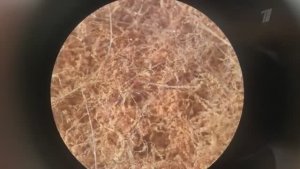 «Добролов» на Первом канале: пылевые клещи и как с ними бороться