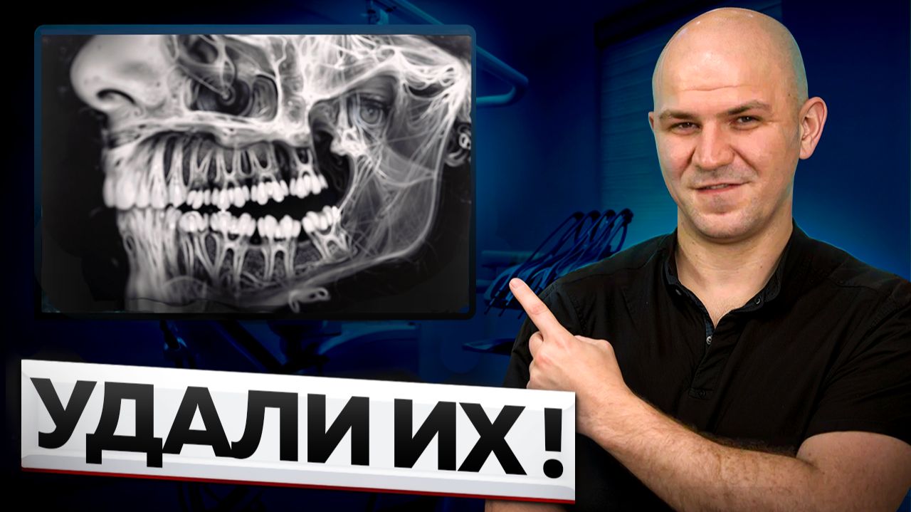 Удаление Зубов Мудрости - Как проходит удаление Восьмерок смотреть онлайн
