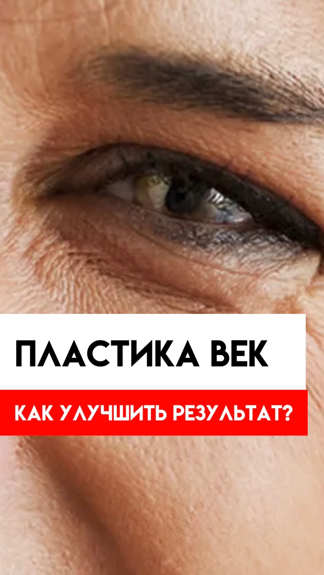 Комплексный подход к омоложению глаз 🔥 смотреть онлайн