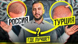 РОССИЯ vs ТУРЦИЯ   ГДЕ ЛУЧШЕ ПЕРЕСАДКА