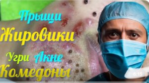 Работа косметолога онлайн ! Самая жирная подборка Угрей