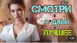 Последствия после  выдавливания прыщей. Смотри не дави