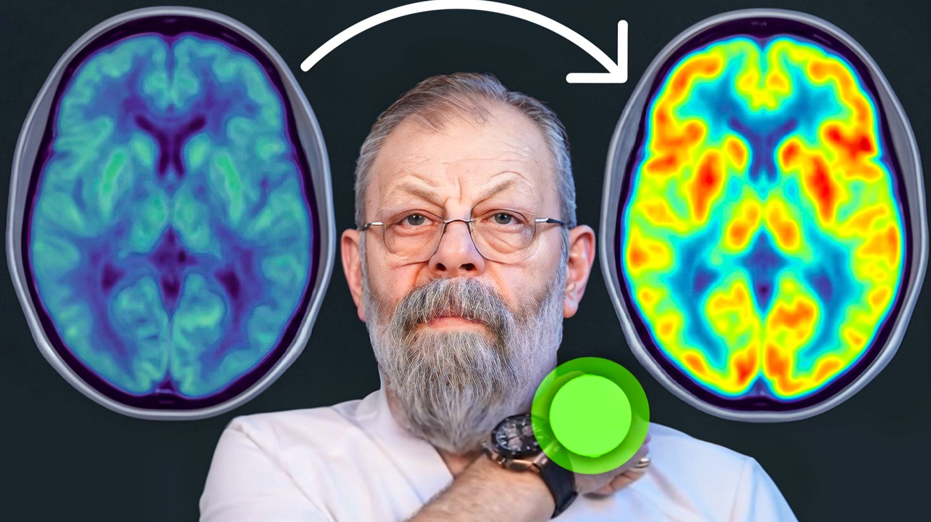 Активация мозга смотреть онлайн