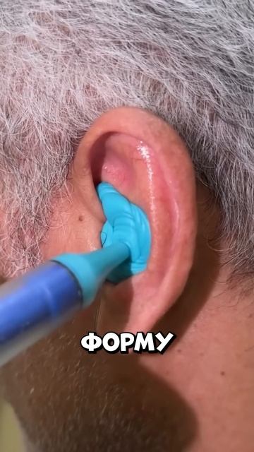 Мужчине заливают в ухо жидкость — но это не лечение #shorts