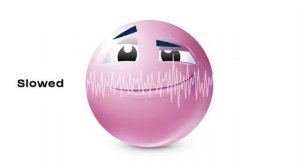 MyinWo, Autxmn Love - CORACAO NA BATIDA (Официальная премьера трека)