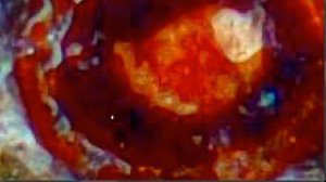 Metriks.MoonDregoN.5Din 5