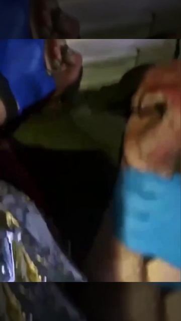 Обморожение конечностей у укоаинских солдат. смотреть онлайн