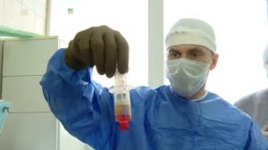 В НИИ травматологии, ортопедии и нейрохирургии СГМУ внедрили новый метод регенеративной медицины