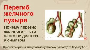 Перегиб желчного пузыря. Почему перегиб желчного — это часто не диагноз, а симптом.